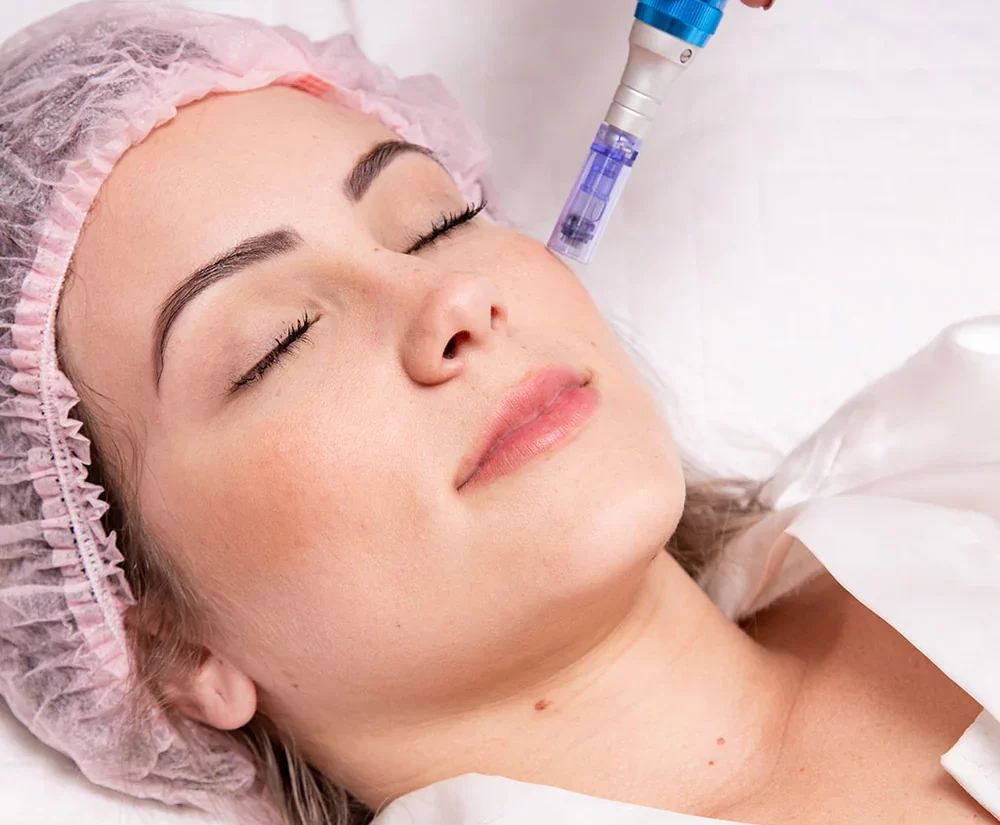 NCTF Treatment in Gurugram