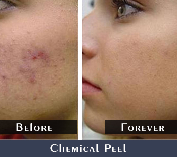 Before/After Dark Spots Treatment Results
