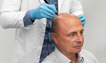 Hair Transplant In Gurgaon