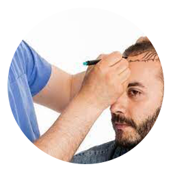 Hair Transplant in Gurgaon