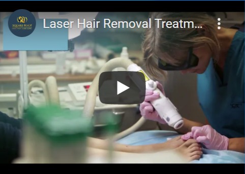 Laser Hair Removal Video