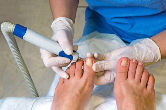 Nail Treatment & Surgeries In Gurgaon 